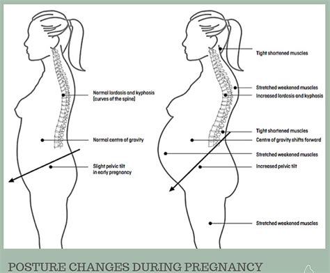 Understanding Back Pain In Pregnancy — Wild Kat Yoga