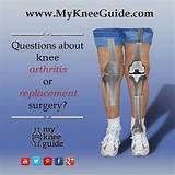 Pain Management After Knee Replacement Surgery Images