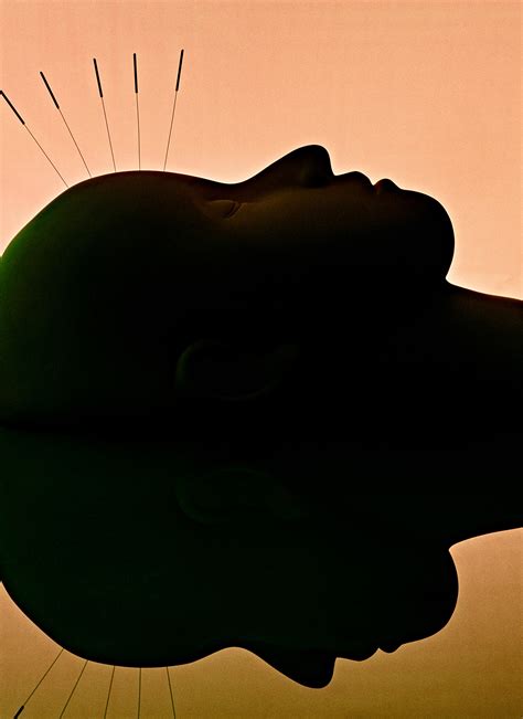 Acupuncture Terms to Know Before Your First Appointment | Allure