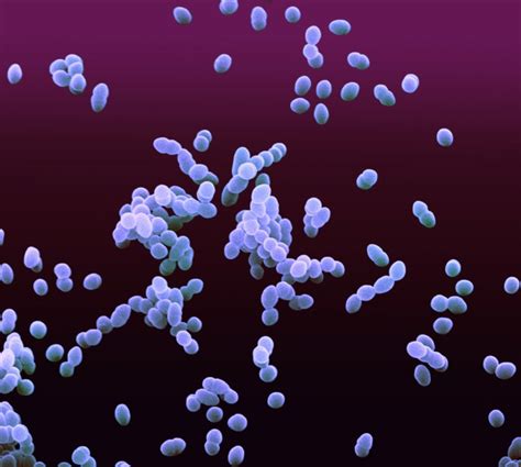 Staphylococcus Aureus Colonization Associated With Food Sensitization