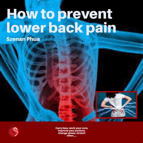 How To Prevent Lower Back Pain Best Acupuncture Hamilton Nz