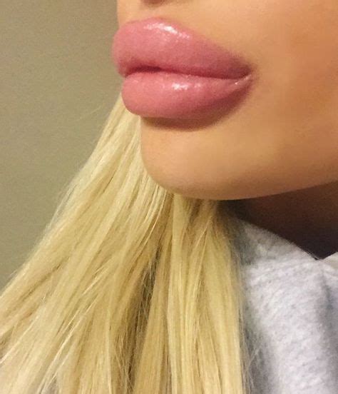 Best Enhanced Lips Images Lips Fake Lips Beauty