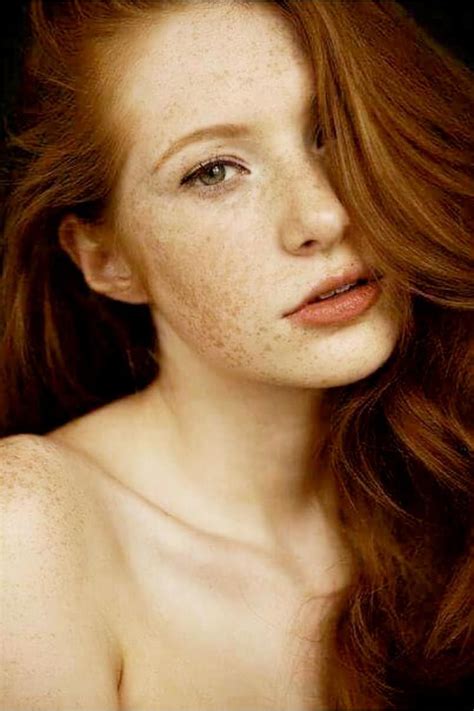 Pin Op Redheads Freckles