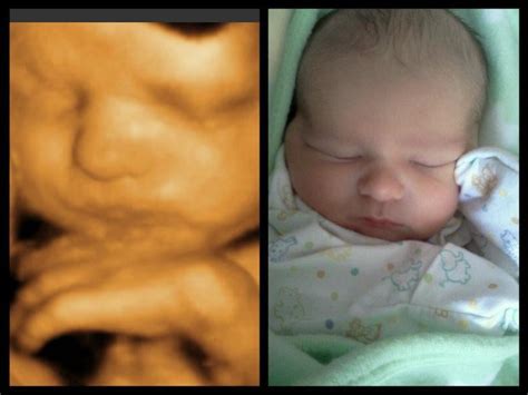 You would be astonished at the. Before & After Baby - 3d 4D Ultrasound | Yelp