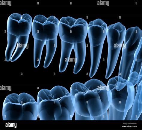 Dental Anatomy Of Mandibular Human Gum And Teeth X Ray View Medically