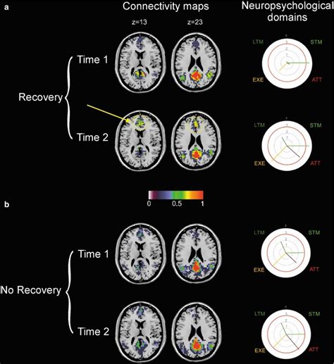 High Field Neuroimaging In Traumatic Brain Injury And Disorders Of