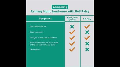 Comparing Ramsay Hunt Syndrome With Bells Palsy Merck Manuals Youtube
