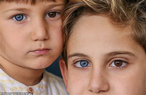 Brothers Are Born With Stunning Different Coloured Eyes Daily Mail Online