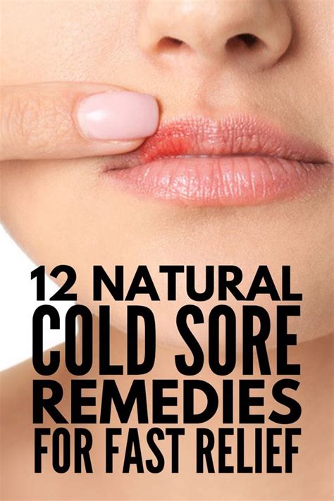 Fast And Effective 12 Natural Cold Sore Remedies That Work Medicine Health Life