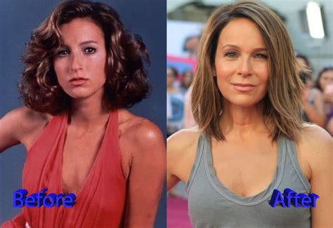 Jennifer Grey Before And After Plastic Surgery