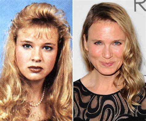 Renee Zellweger Before Plastic Surgery — What Her Face Looked Like In