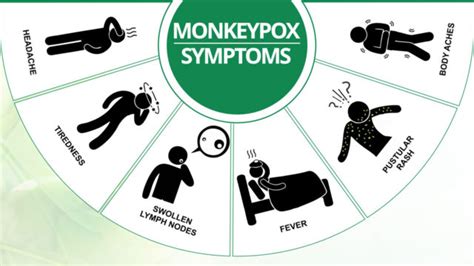 Monkeypox is a rare disease that is caused by infection with monkeypox virus. Preparing for the next epidemic | The Guardian Nigeria ...