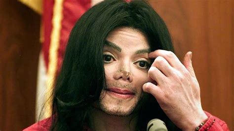 Michael Jackson Calvo Y Con Cicatrices En Todo El Cuerpo Revelan