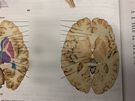 Transverse Section Of Brain Diagram Quizlet