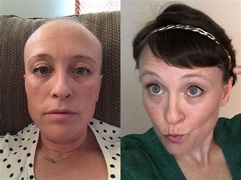 Share 65 Hairstyles After Chemo Super Hot In Eteachers