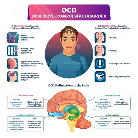 ocd obsessive compulsive disorder labeled explanation vector illustration vectormine