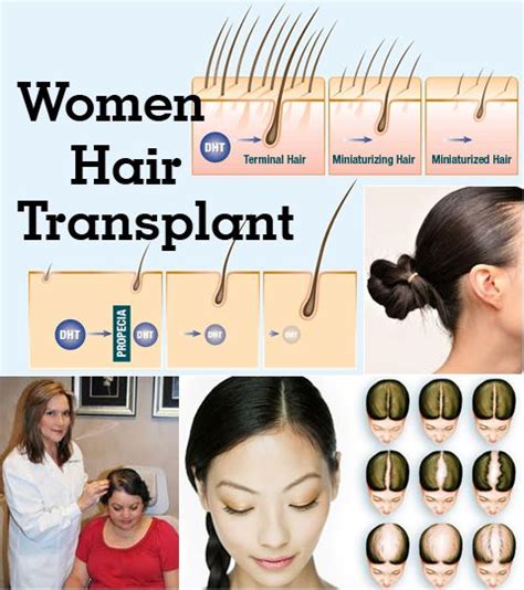 We also follow the best hygienic practices in order to provide a comfortable experience to our patients. For Latest and best quality hair transplant in India at ...