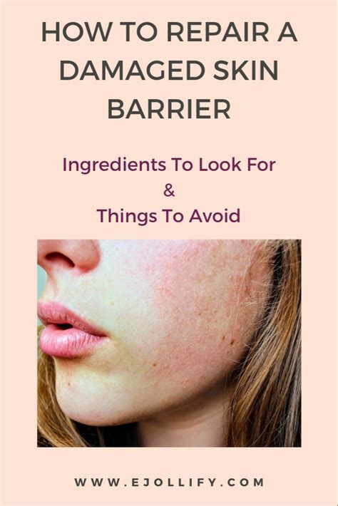 9 Tips On How To Repair Damaged Skin Barrier In 2020 Damaged Skin
