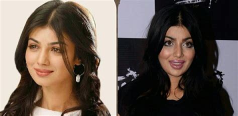 Ayesha Takias Plastic Surgery Goes Wrong And Fans Cant Handle It