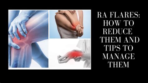 Rheumatoid Arthritis Flares How To Reduce Them And Tips To Manage Them Capsaicin Cream