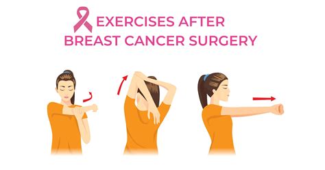 Exercises After Undergoing Breast Cancer Surgery Poorti A Product Of