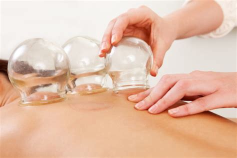 Cupping Therapy — Miami Sports Chiropractic And Yoga Center