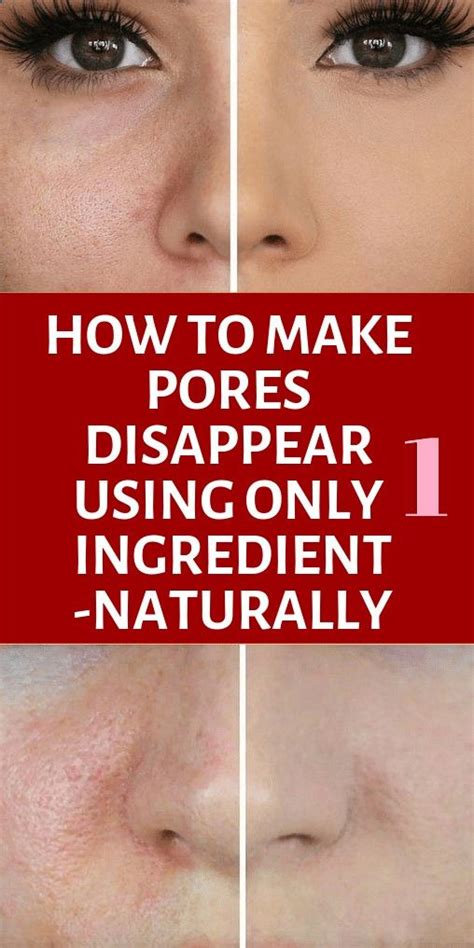 How To Make Pores Disappear Naturally Using Only 1 Ingredient Natural