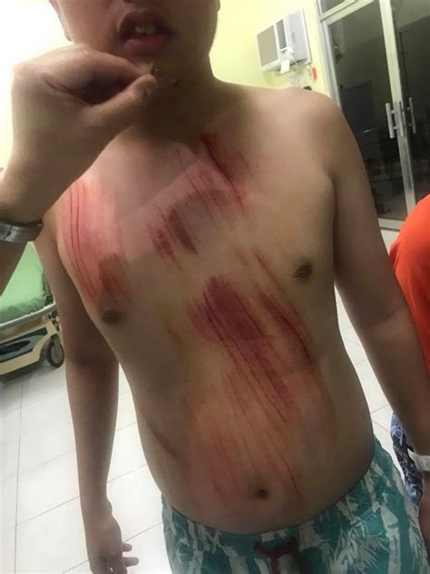 Check spelling or type a new query. Karen Davila's son involved in surfing accident in Siargao ...