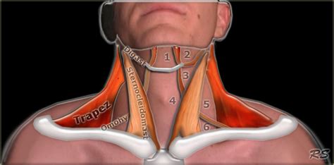 The Radiology Assistant Infrahyoid Neck
