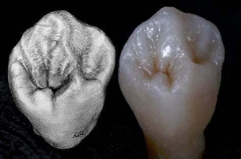 Mastering Posterior Morphology Composites Aspiredental