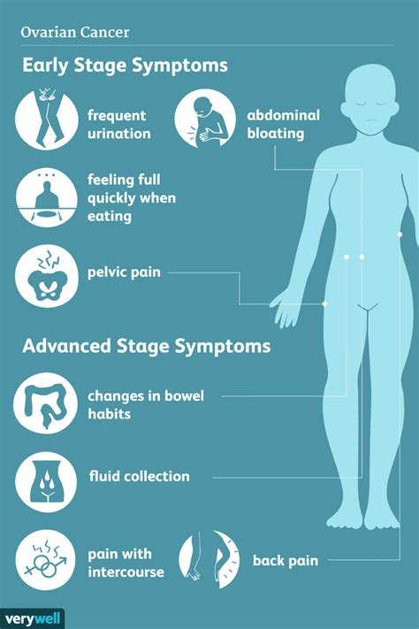 Ovarian Cancer Signs Symptoms And Complications