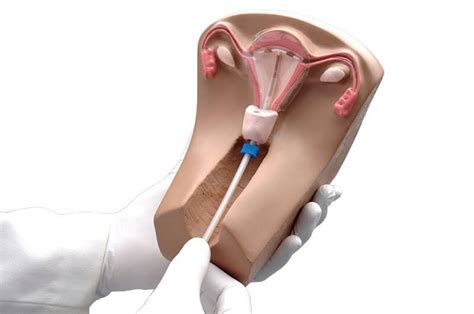 Mild spotting and cramping for the first three to six months. All You Need To Know About Getting IUD As A Form Of Birth ...