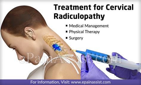 Cervical Radiculopathy Treatment Causes Symptoms