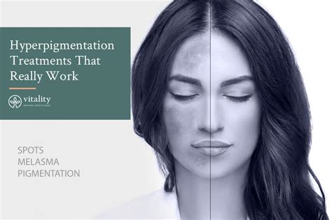 A Look At Hyperpigmentation Treatments That Really Works