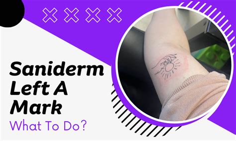 Update More Than 69 Saniderm Tattoo Healing Stages Latest Esthdonghoadian
