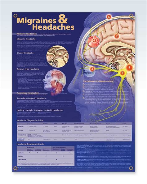 Migraines And Headaches Exam Room Anatomy Poster Clinicalposters