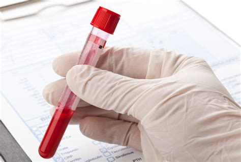 Diagnostic Procedure And Hemolytic Anemia Test