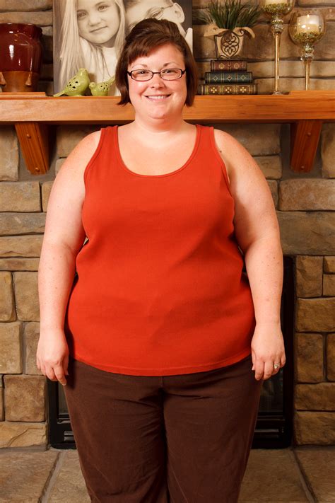 I had been warned before surgery that the hair loss would come, and it started. Ali's Alley: Gastric Sleeve