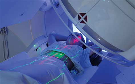 Stereotactic Body Radiation Therapy A New Paradigm For Radiation Treatment In Lung Cancer Rsna