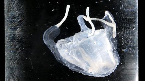 Irukandji Jellyfish Sting At Agnes Water Central Queensland Coast