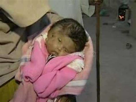 Meditation will cultivate your awareness of the subtle. Baby born with two faces, four eyes, two noses, two mouths ...