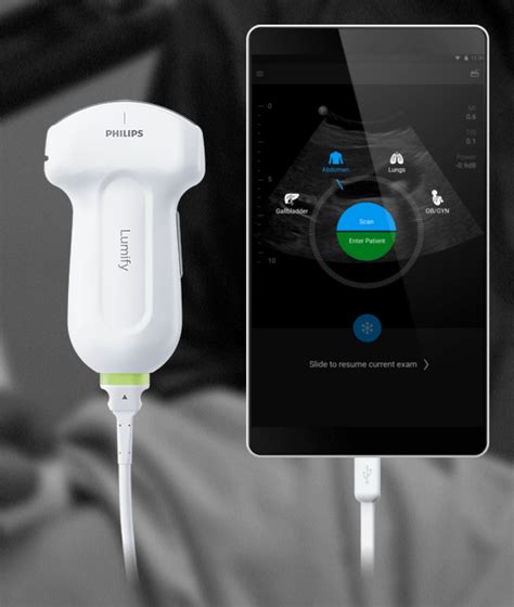 Philips Launches Lumify Smart Device Ultrasound Solution In 2021