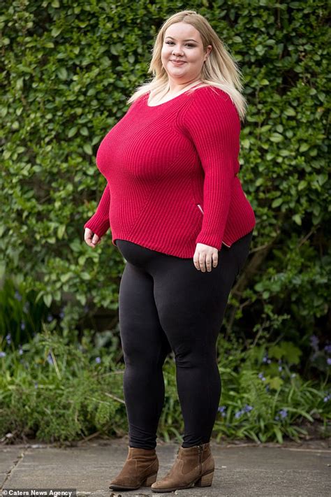 Meet 25 Year Old Lady With Gigantic Breasts That Wont Stop Growing Due To A Rare Condition