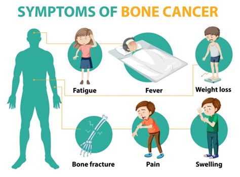 Bone Cancer Specialty Care Clinics