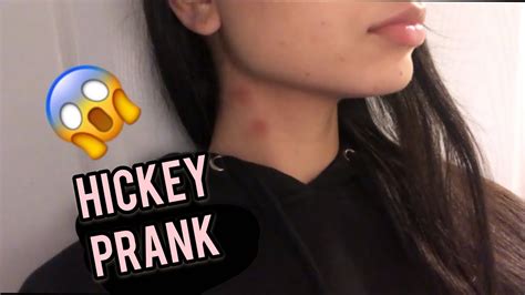 Hickey Prank On My Brother He Spazzed Out🤦🏻‍♀️ Youtube