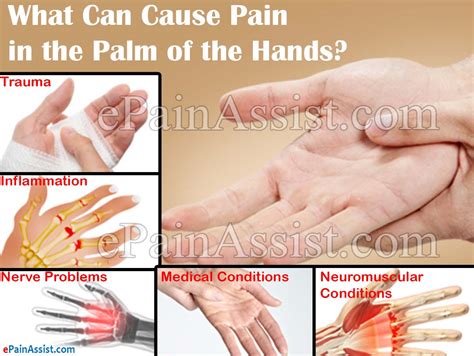 What Can Cause Pain In The Palm Of The Hands