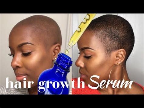 The anagen (growing) phase of hair growth is when the. 100% Natural HAIR REGROWTH Serum | 2 Month Update - # ...