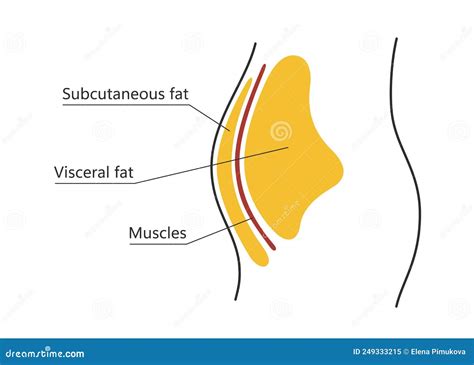 Visceral And Subcutaneous Fat Around Waistline Location Of Visceral Fat In Abdominal Cavity