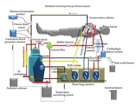 Overview Of A Standard Extracorporeal Circulation System Upper Panel