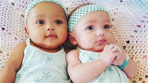 Love Is Love Biracial Twins Born In Illinois With Different Skin